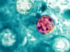 ¿Qué es la Cyclospora y cómo mitigar el riesgo?