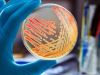 Bioburden, ¿análisis necesario en la industria manufacturera de dispositivos médicos?
